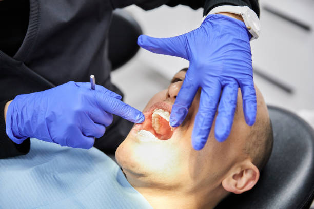 Best Dentist for Tooth Abscess  in Anacortes, WA